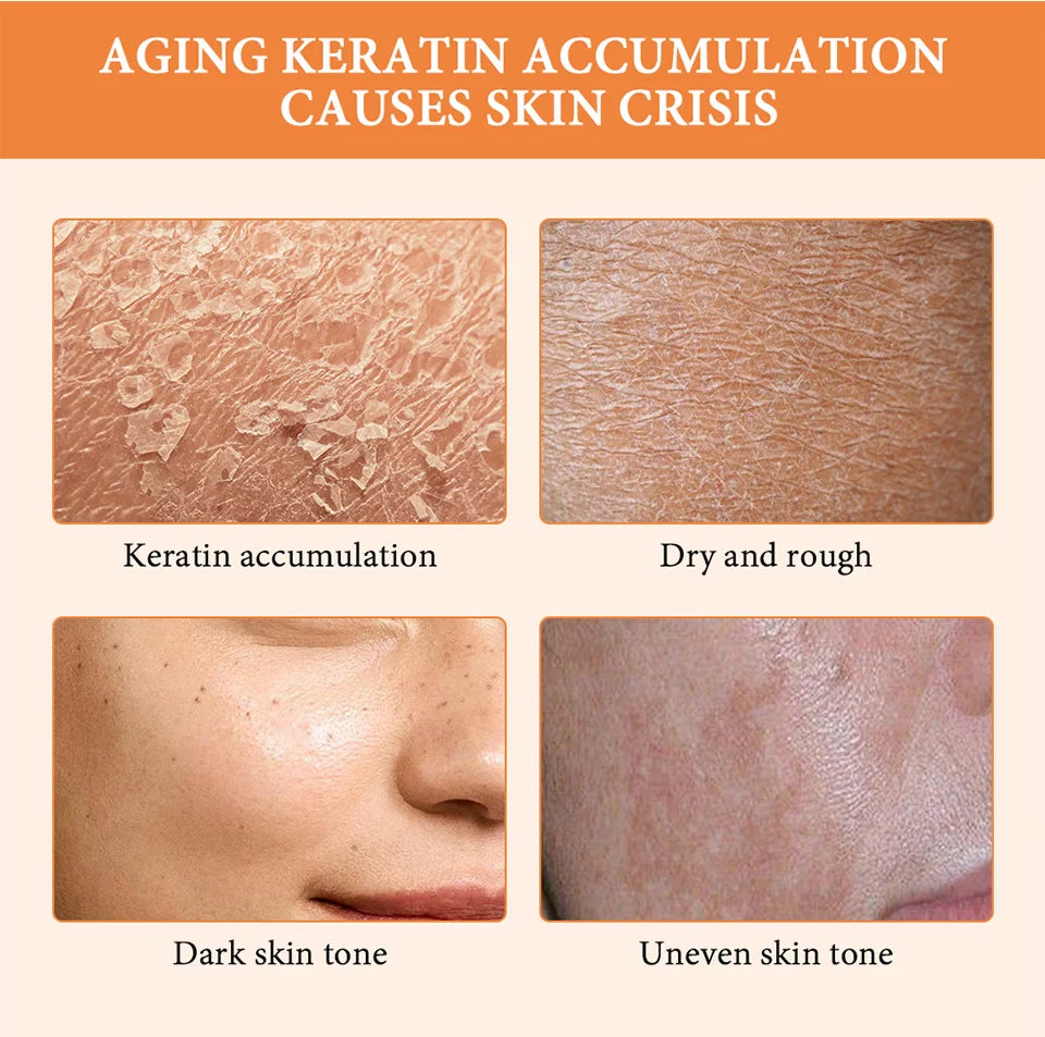 Original Exfoliating Gel Dead Spot Remover Brighten Peeling 50g Gentle Repair Scrub Whiten Hydrating Moisturizer Korean Skin Car