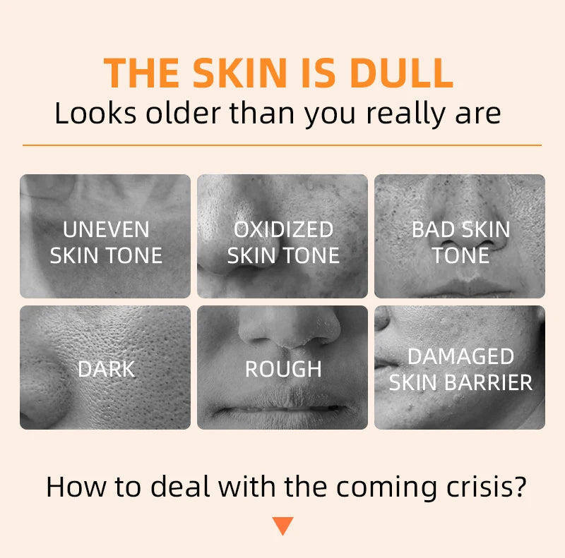 Orange Exfoliating Gel Dead Spot Remover Brighten Peeling 50g Gentle Repair Scrub Whiten Hydrating Moisturizer Korean Skin Care
