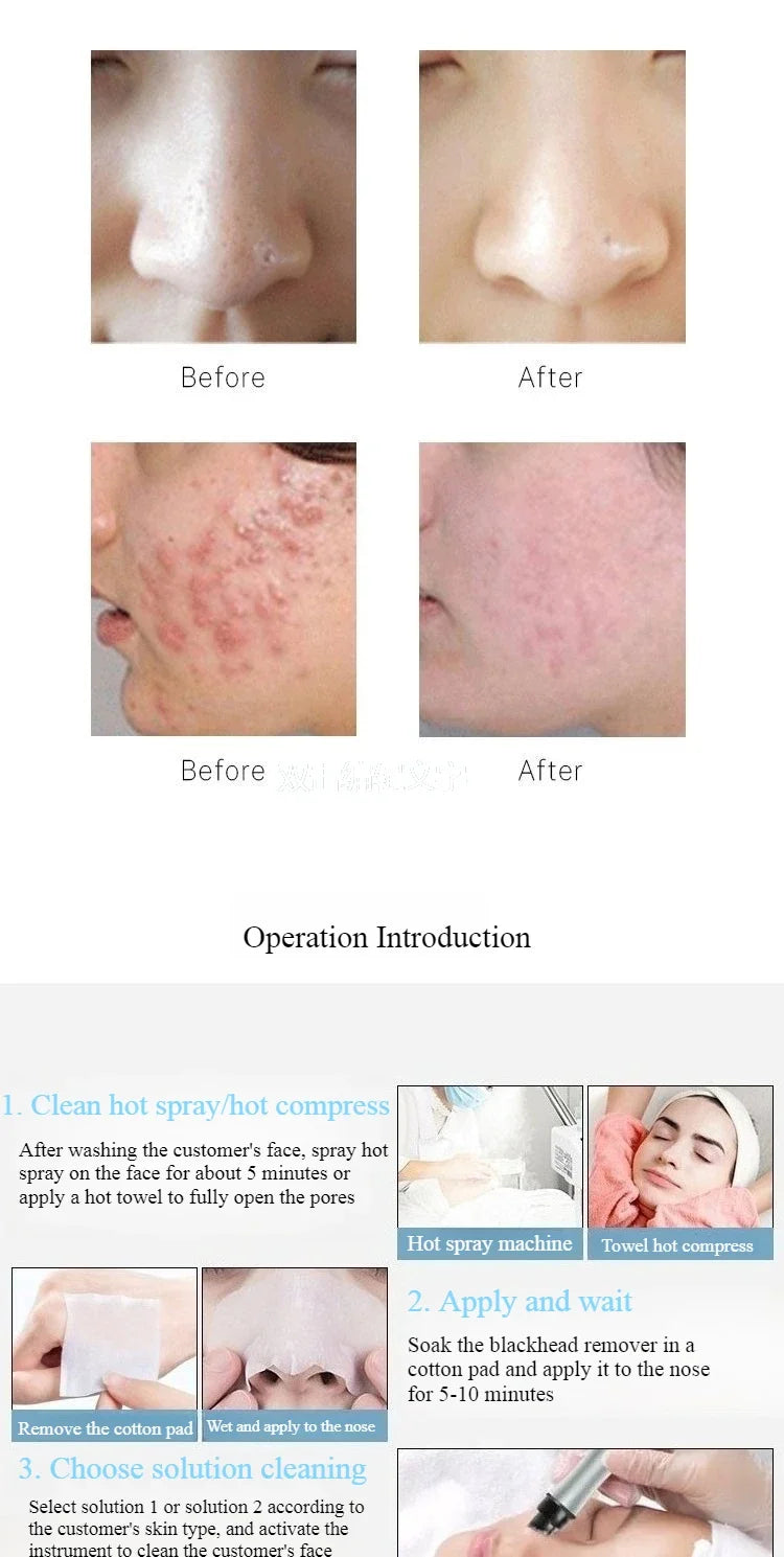 500ml Aqua Hydra Peeling Solution Facial Serum for Dermabrasion Machine Moisturize Repair and Soothe Deep Clean Exfoliate